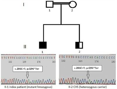 A Novel Nonsense Mutation in FERMT3 Causes LAD-III in a Pakistani Family